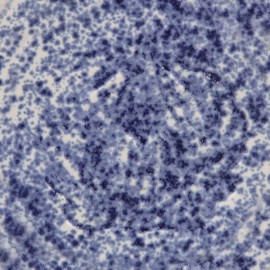 Blue Splatterware - 16 oz Mayco Stoneware Glaze